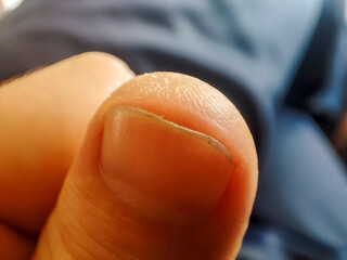 Close-up of a thumb showing skin texture and a natural, unpolished appearance, highlighting the...