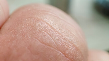 Fototapeta premium Close-up of a human hand's skin texture, showcasing fine details and lines. Perfect for beauty or health-related projects.