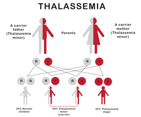 The thalassemia diagram shows how thalassemia is inherited from parents to children. 