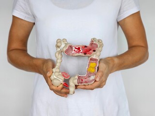 Woman holding human colon anatomy model on white background