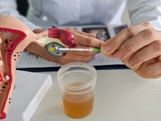 Model of female reproductive system and positive pregnancy test