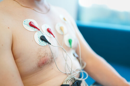 Young man with cardio monitor ECG sensors on his chest, home daily ECG monitoring. Saint Petersburg, Russia - 10 July 2024