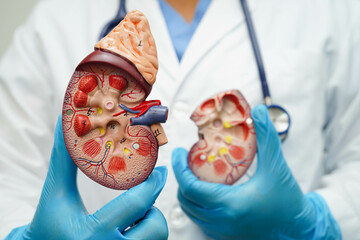 Chronic kidney disease, doctor with model for treatment urinary system, urology, Estimated...