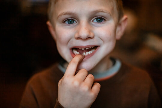 Closeup of little boy pointing to lost tooth