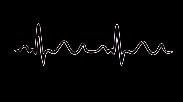 heart beat on monitor