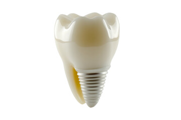 Dental implant model, demonstrating technology for tooth replacement, isolated on white background.