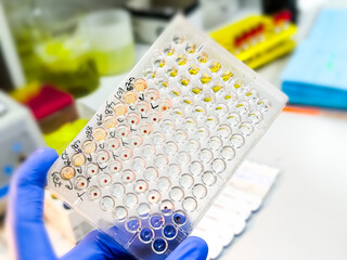 Hemagglutination assay for T. pallidum antibodies. TPHA. ELISA plate, serology testing method in medical laboratory