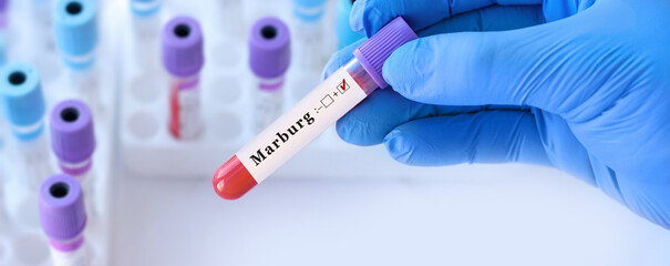 Doctor holding a test blood sample tube with positive marburg virus. Marburg virus is transmitted...