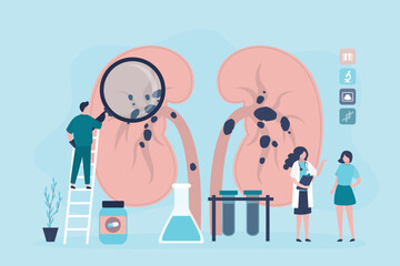 Nephrology, doctors examines and diagnoses urinary tract disease. kidney failure, kidney stones, medical concept. Chronic infection. illness diagnosis and treatment.