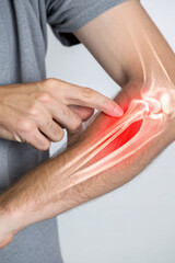 Elbow Pain Illustration with X-Ray Highlighting Tendonitis &ndash; Medical Concept Image for Injury and Joint Issues