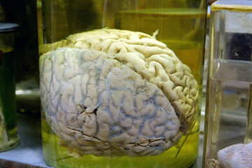 Real human brain. Anatomy of brain, grey substance, grey matter, cortical grey