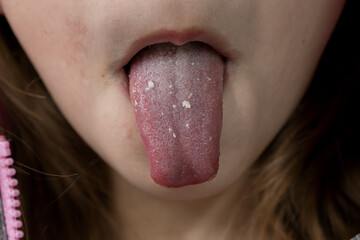 Close-up of a Human Tongue Showing Distinctive Texture and Coating