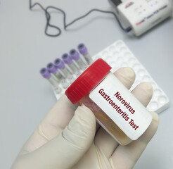 Stool test sample for Norovirus Test in doctor hand. Norovirus gastroenteritis.