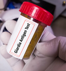 Biochemist hold feces sample for Giardia Antigen test to diagnosis of Giardiasis. Rotavirus antigen...