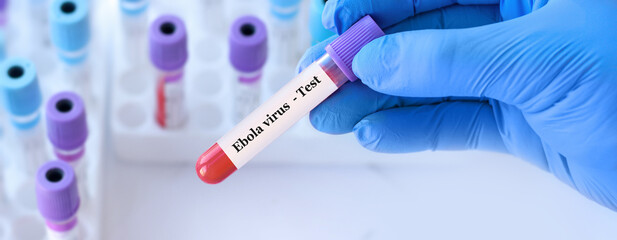 Obraz premium Doctor holding a test blood sample tube with Ebola virus test on the background of medical test tubes with analyzes.