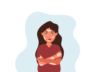 Portrait of a happy young woman with vitiligo. Close up of woman with skin disorder. Female character with vitiligo. Vector illustration on isolated background.