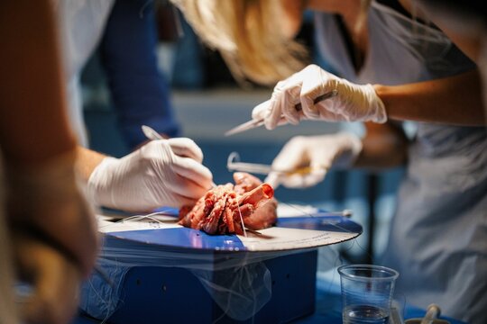 Medical students dissecting a heart in a lab