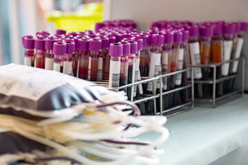 Close up of group of blood sample tubes of a blood donor, sample tubes for collecting patient's blood for laboratory diagnosis, medical equipment, Save life and medical treatment concept.