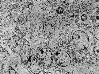 Anterior pituitary. Cell types