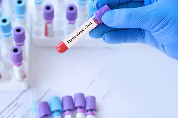 Doctor holding a test blood sample tube with Ebola virus test on the background of medical test tubes with analyzes.