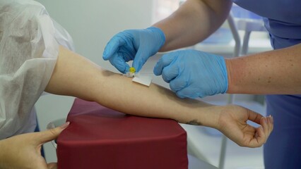 Medical professional inserting an intravenous catheter into a patient's arm for administering fluids or medication