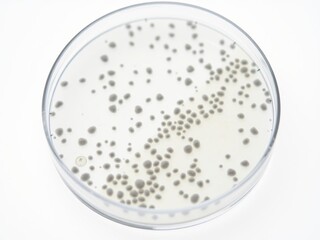Close-up of a petri dish segment filled with colorful microbial colonies on a white background, laboratory, culture, microbiology