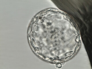 Hatched human blastocyst. Grade BA. on the fifth day of development. Viewed under the microscope.