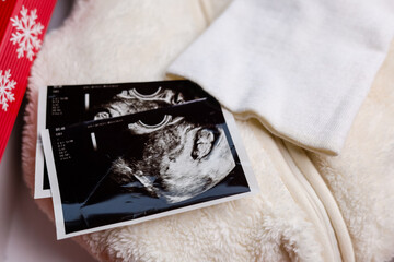 Prenatal ultrasound screening photo with white newborn clothes, hat