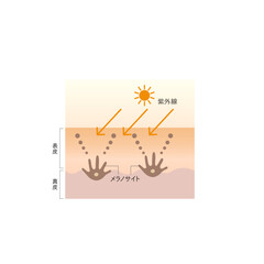 図版_肌図版_022_紫外線とシミの関係
