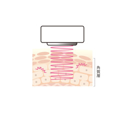 図版_肌図版_027_美顔器_キャビテーション