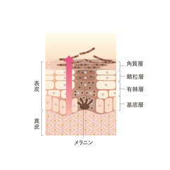 図版_肌図版_028_シミのある肌のターンオーバー