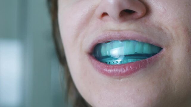 Woman putting a dental aligner orthodontic night guard on her teeth. Close up.