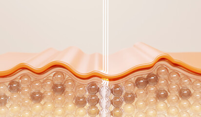 laser or serum vitamin through the skin layer for repair wrinkles and reduce up saggy skin of the skin cell. Skin repair Concept.	