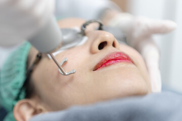 Woman receiving pico laser facial treatment in beauty Clinic.