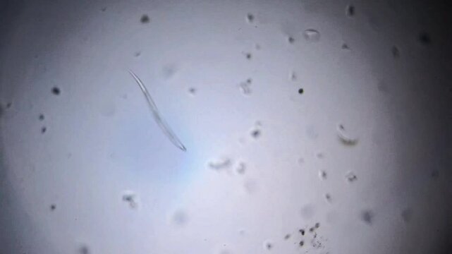 A moving nematode under a microscope.