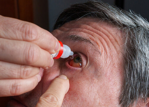 Man applying post-surgery eye drops for retinal detachment recovery