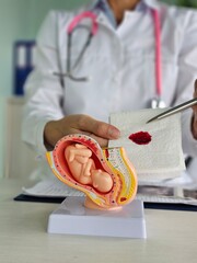 Gynecologist holds napkin with blood and embryo in concept clinic concept
