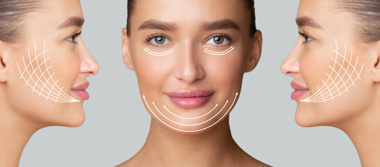 Cosmetology Concept. Collage of side and front view portrait of woman with arrows on face for...