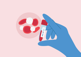 Doctor's hand in glove hold a negative HIV test tube. Blood and white immune cells under the microscope.Vector illustration in flat style.