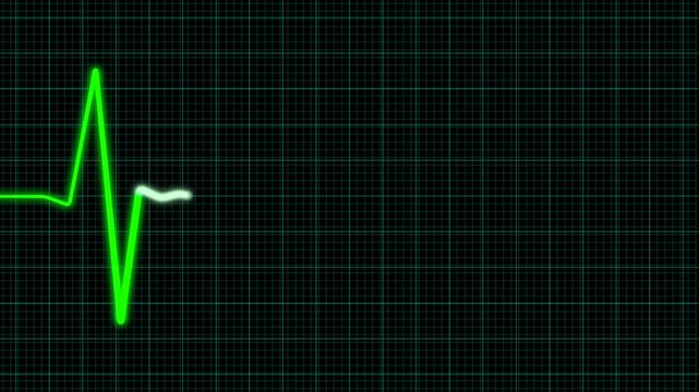A Heartbeat Monitor Waveform Display presented in an eyecatching shade of green