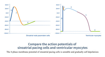 The 4-phase membrane potential of sinoatrial node pacing exhibits spontaneous depolarization, while the 4-phase membrane potential of ventricular myocytes remains stable.