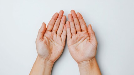 Person with allergic contact dermatitis on the hands, showing red, itchy, inflamed skin   contact dermatitis, inflamed skin, hand problem