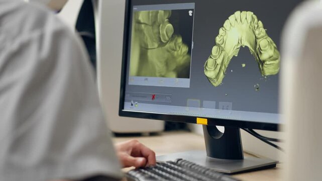close up professional laboratory for production of dental protozoa veneers and crowns in a scanning machine dental impression to create a 3D model 360 degree rotation professional supervision