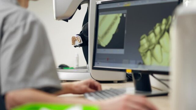 professional laboratory for production of dental protozoa veneers and crowns in a scanning machine dental impression to create a 3D model 360 degree rotation professional supervision