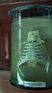 Internal organs of human in medical museum. Anatomical organs in glass tubes with formaldehyde. Vertical video