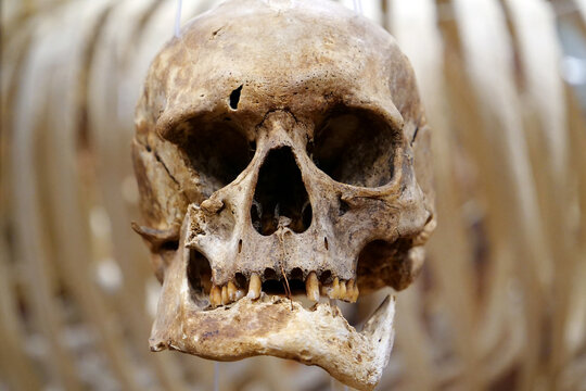 Bones of human skull. Human skull. The face of death