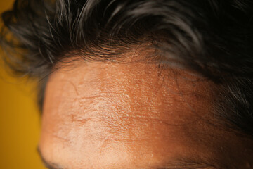 closeup of sweat on forehead against dark background ,