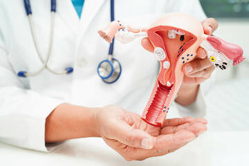 Uterus, doctor holding human anatomy model for study diagnosis and treatment in hospital.