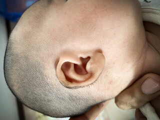 Fototapeta premium Hair around the ears of newborns.