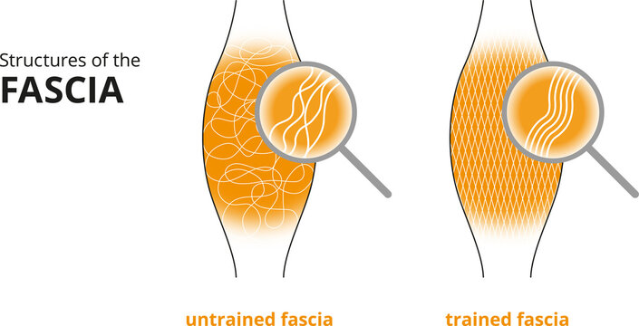 Illustration of a trained and untrained fascia